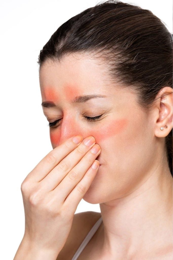 Sinusitis