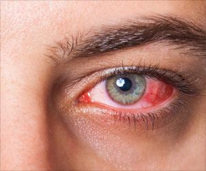 eye
