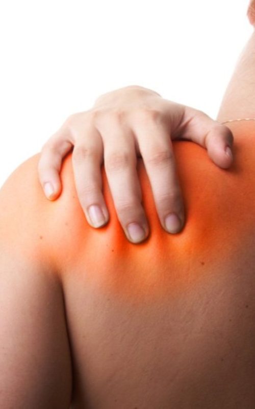 ANKYLOSING SPONDYLITIS